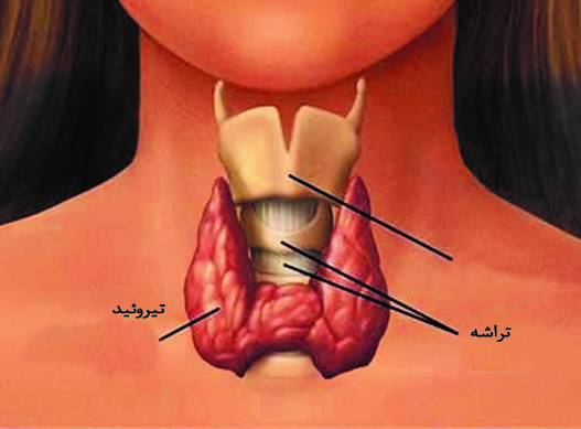 پركاري تيروييد